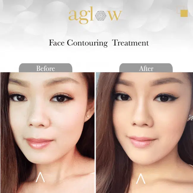 Face-Contouring-Treatment-650x650